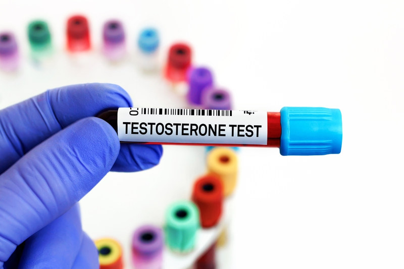 Testosterone Test