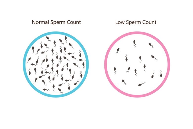 Low Sperm Count